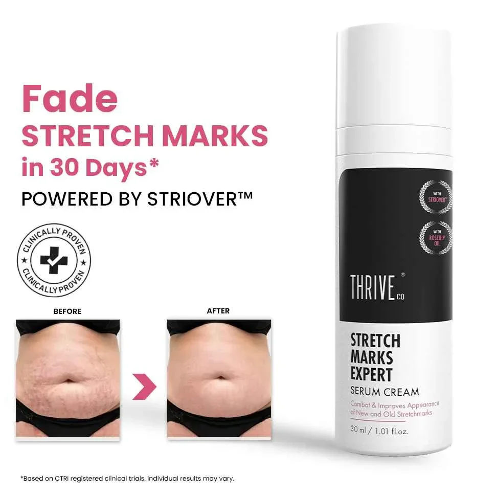 Stretch Marks Expert, Serum Cream, 30ml