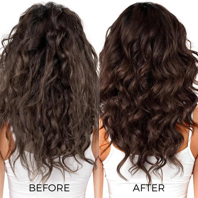 Ultimate Dandruff Control Kit for Itchy, Flaky Scalp - Image 6